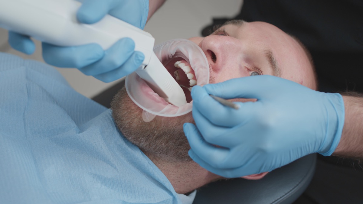 Close up: Doctor scans the teeth of a male patient in the medical office of clinic. The dentist holds in his hand a manual 3D scanner for the jaw and mouth. Dental health. Creates a 3D model of teeth