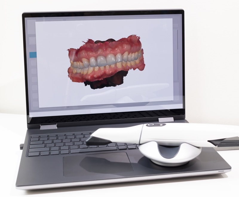 3D Picture of Scanned Teeth on Monitor of Computer, Notebook. White 3d Intraoral Dental Tooth Scanner Lying on Table. Dental Equipment, Device For Scanning Teeth. Copy Space. Vertical Plane.